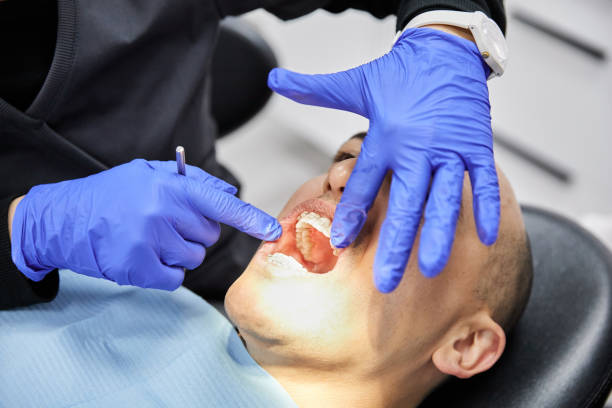 Best Emergency Gum Treatment in Lost Hills, CA